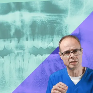Etiology of Malocclusion: Does evidence or opinion exist in favour of an environmental cause?