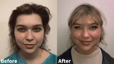 Everything you need to know about Recessed Chin