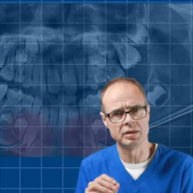 The Risks of Traditional Orthodontic Approaches on Long-Term Health